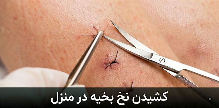 کشیدن-نخر-بخیه-در-منزل